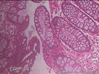 直乙结肠粘膜图17