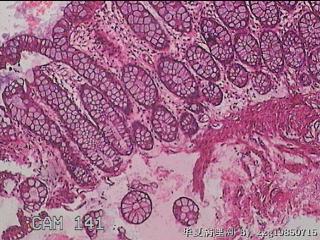 直乙结肠粘膜图12