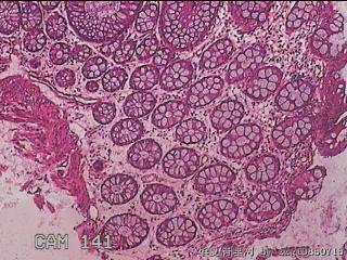 直乙结肠粘膜图7