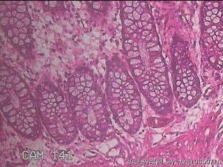直乙结肠粘膜图25