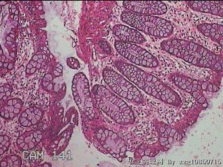 直乙结肠粘膜图4
