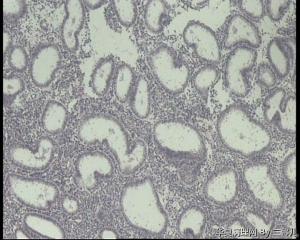 请老师看看34岁子宫内膜图3