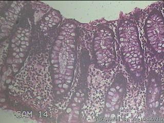 乙状结肠粘膜图6