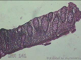 乙状结肠粘膜图1