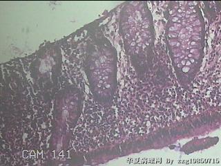 乙状结肠粘膜图4