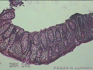 乙状结肠粘膜图2
