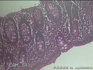 乙状结肠粘膜图5