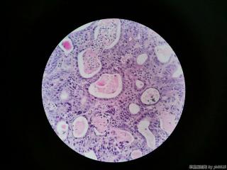 贲门活检图13