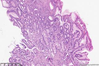 请教老师们这个胃窦粘膜有萎缩吗？图7