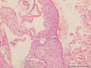 宫颈组织图8