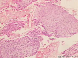 宫颈组织图10