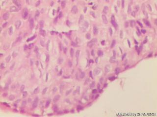 宫颈组织图11