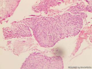 宫颈组织图4