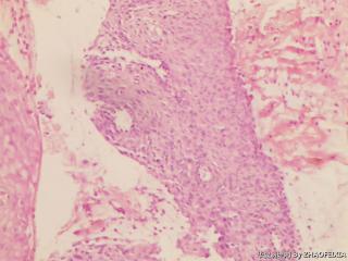 宫颈组织图7