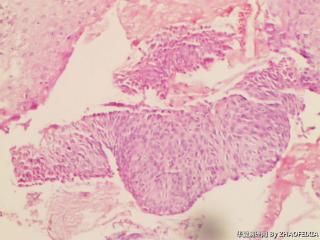 宫颈组织图6