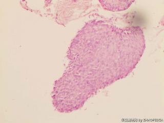 宫颈组织图3