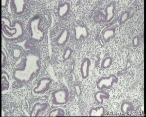 请教老师，46岁宫内膜图1