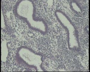 请教老师，46岁宫内膜图3