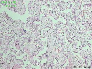 胎盘组织，请教？图2