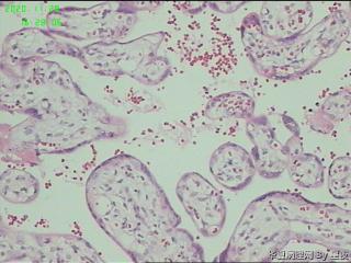 胎盘组织，请教？图9