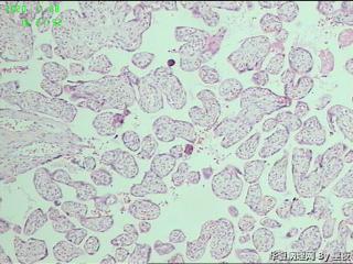 胎盘组织，请教？图5