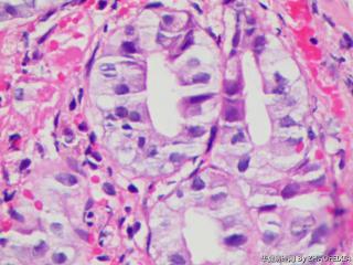 结肠组织（肠镜活检）图31