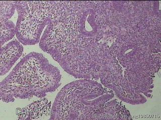 宫腔组织图19