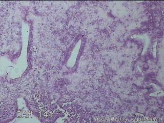 宫腔组织图3