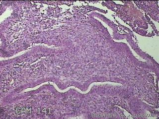 宫腔组织图13