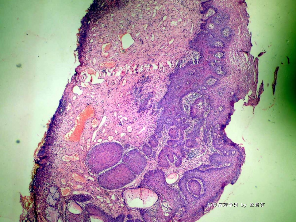 宫颈组织图1