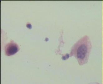 HE染色液基  TCT16,请教各位老师图1