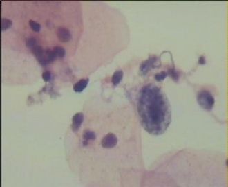 HE染色液基  TCT16,请教各位老师图11