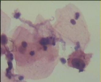 HE染色液基  TCT16,请教各位老师图15