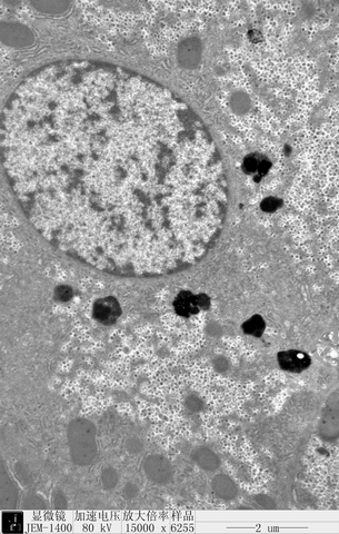 肝细胞电镜图图片