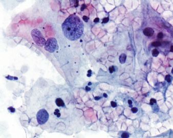 宫颈液基,组织学已上传图7