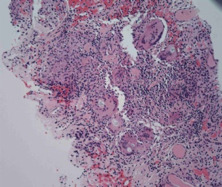 Young adult with elevated creatinine图9