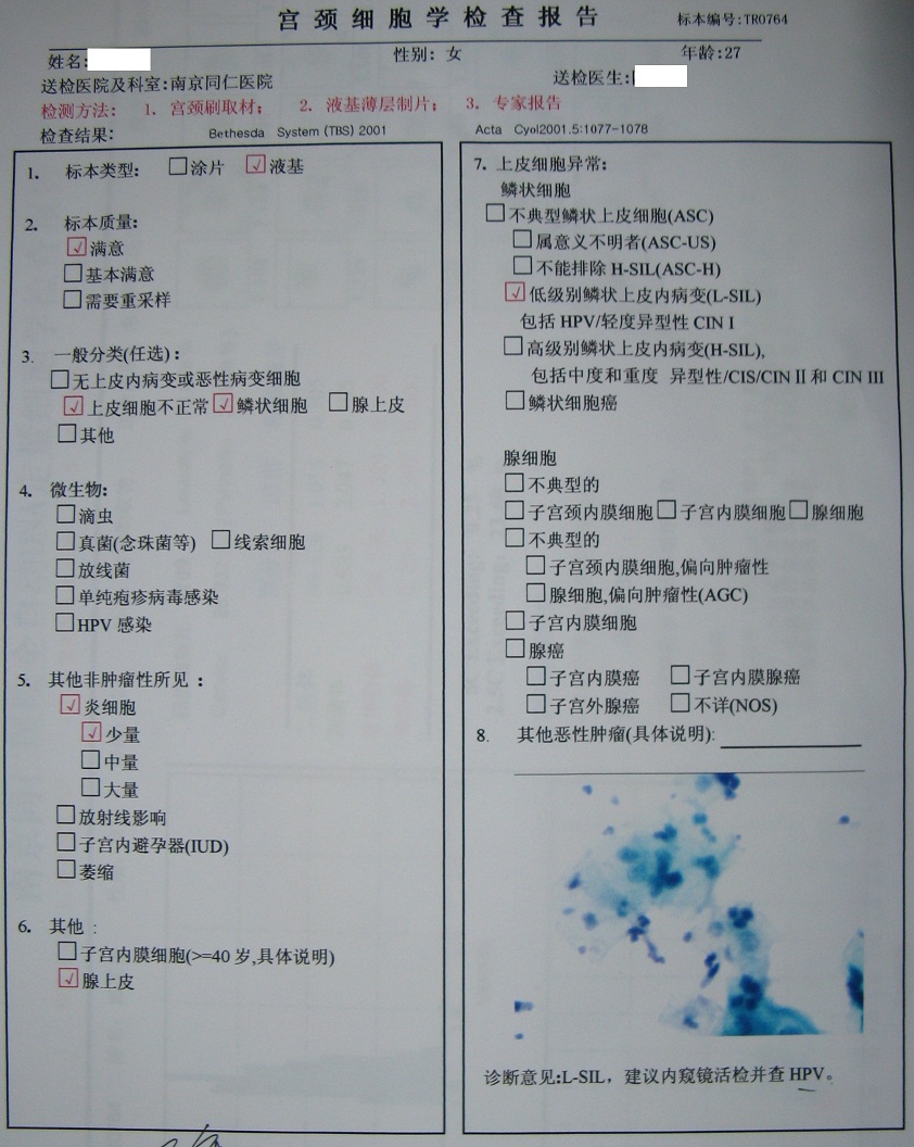 宫颈细胞学检查报告图1