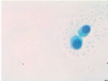 SJ118，传统涂片图6